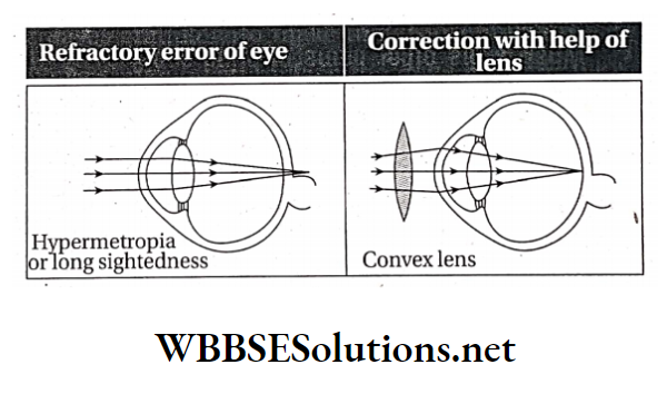 WBBSE Solutions For Class 10 Life Science And Environment Chapter 1 Eye As A Sense Organ In Human Hypermetropia and its correction