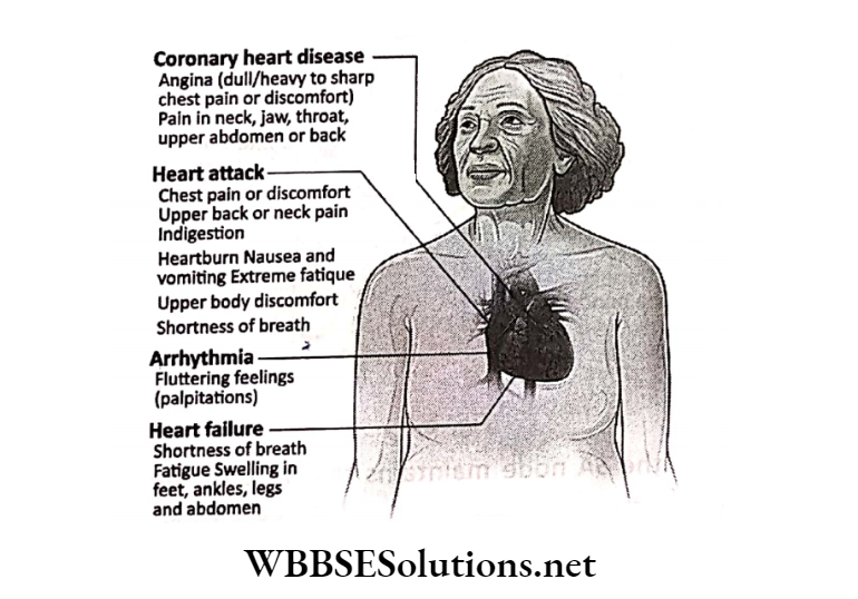 WBBSE Solutions for class 6 chapter 8 the human body congenital heart dissease