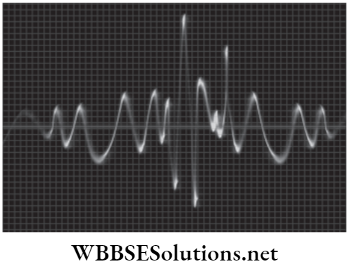 NEET Foundation Physics Sound Sound Wave