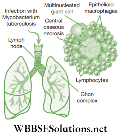 NEET Foundation Biology Why Do We Fall Ill Lungs infected with mycobacterium