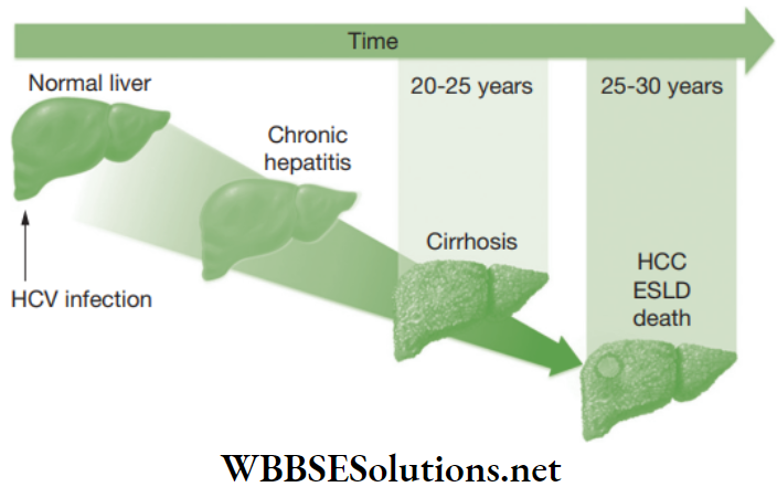 NEET Foundation Biology Why Do we Fall Ill Stages of liver hepatitis